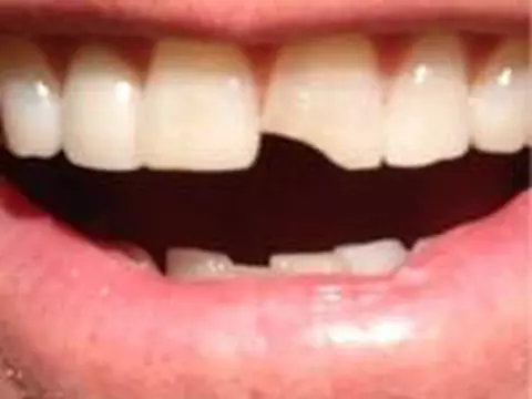 Débi & Loide 2 | Jim Carrey publica foto com dente quebrado