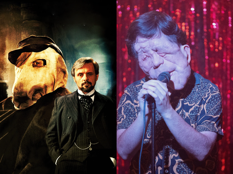 Adam Pearson Estrelará o Remake de 'O Homem Elefante' com Início de Produção em 2026
