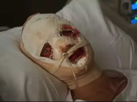 Cara-de-Barro | Exibições de teste comparam filme com Coringa e A Substância