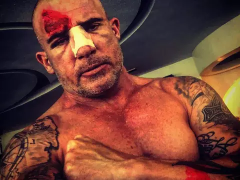 Prison Break | Dominic Purcell se acidenta no set e publica foto sangrando