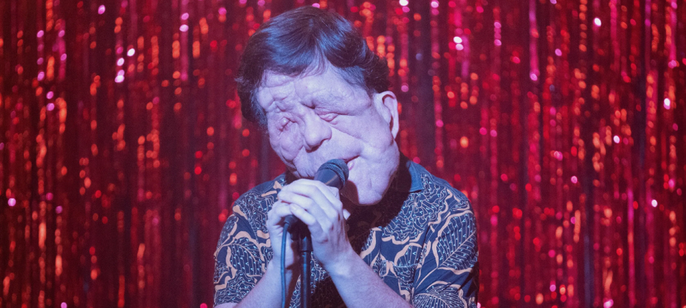 Adam Pearson Estrelará o Remake de 'O Homem Elefante' com Início de Produção em 2026