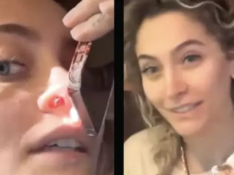 Paris Jackson mostra furo no nariz por abuso de drogas; veja o vídeo